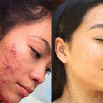 image for transformation 2 image for transformation 2