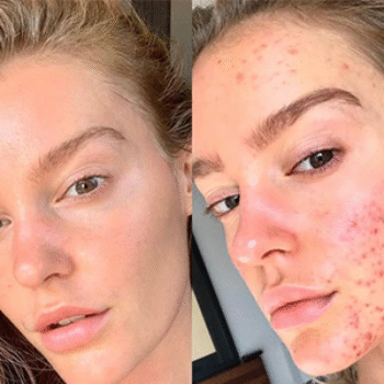 image for transformation 3 image for transformation 3